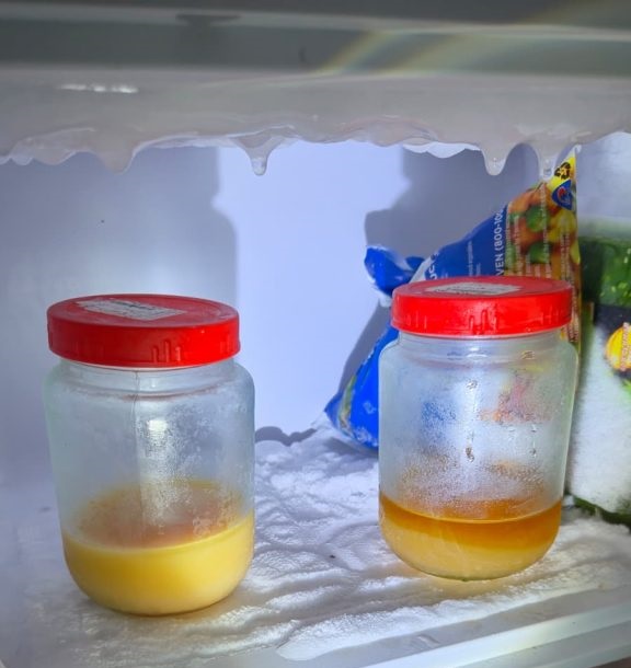 kidney filtration