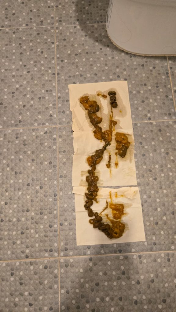 mucoid plaque